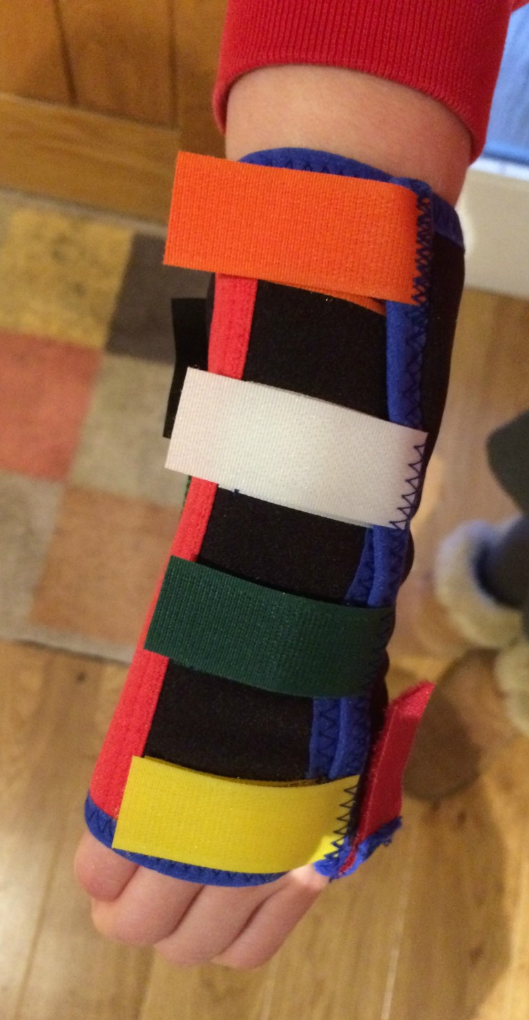 Sprained wrist, Daughter, 365, 366