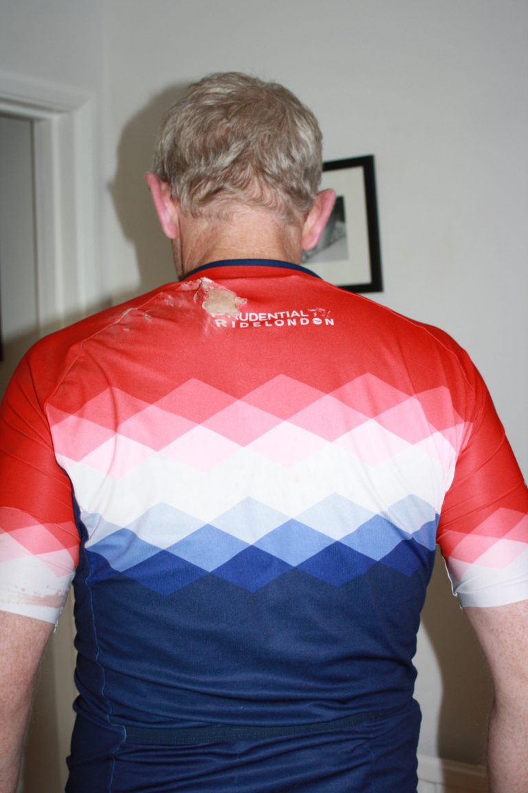 Husband, Bike crash, 365, 366