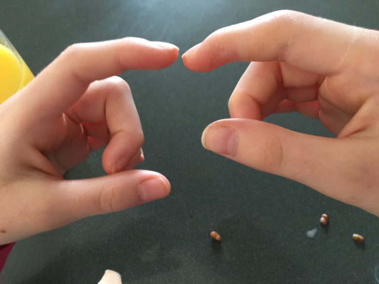 Finger, Injured finger, Swollen finger, Daughter, 365