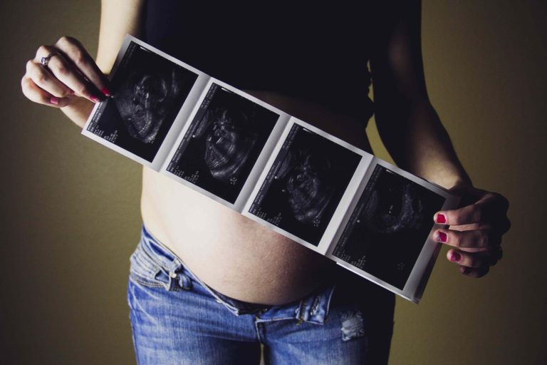 pregnancy, scan photos